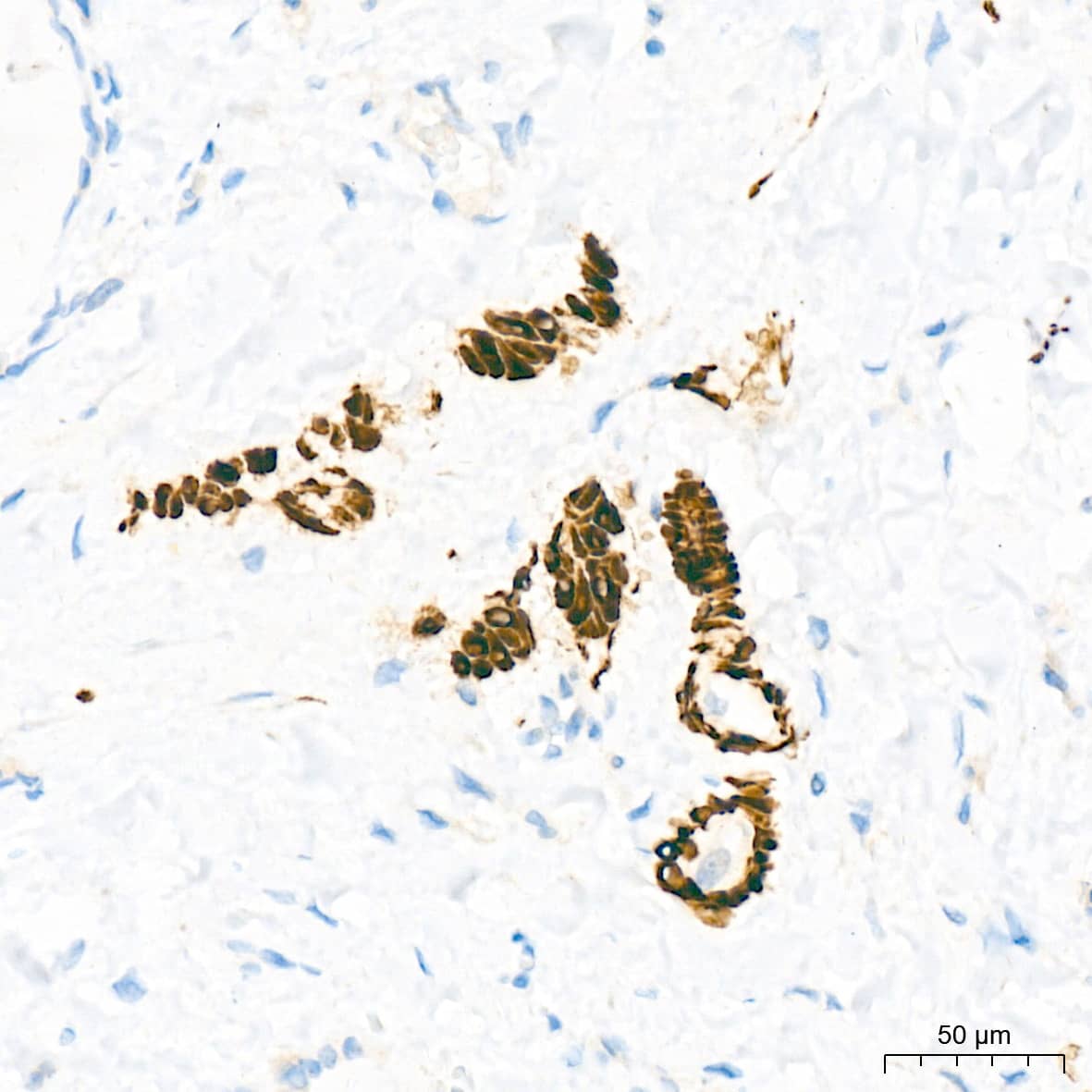 Immunohistochemistry: Desmin Antibody (6O9O4) [NBP3-33531] - Immunohistochemistry analysis of paraffin-embedded Human thyroid tissue using Desmin Rabbit mAb at a dilution of 1:1600 (40x lens). High pressure antigen retrieval was performed with 0.01 M Tris-EDTA buffer (pH 9.0) prior to IHC staining.