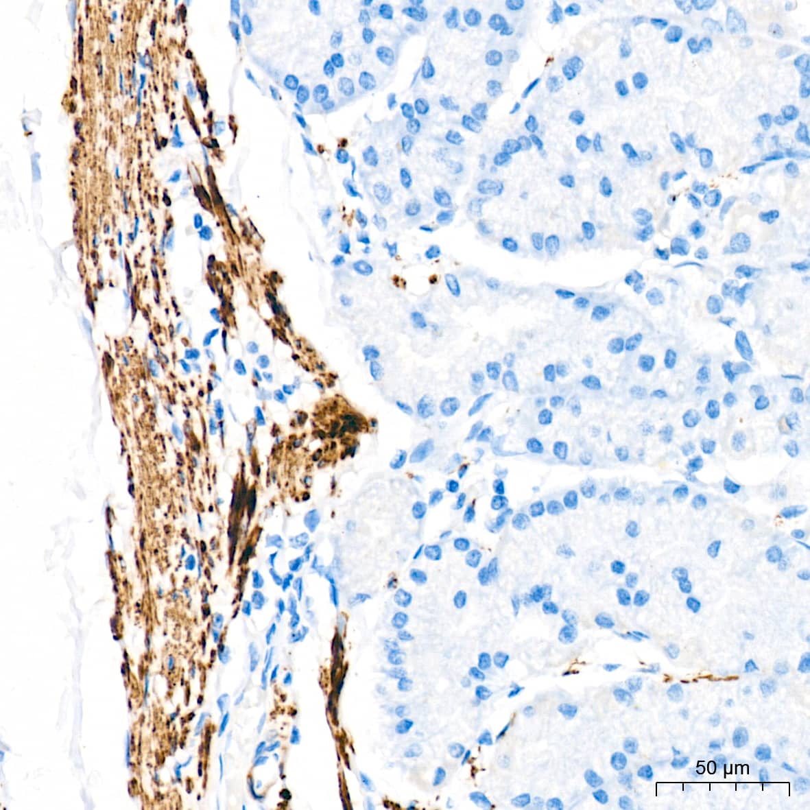 Immunohistochemistry: Desmin Antibody (6O9O4) [NBP3-33531] - Immunohistochemistry analysis of paraffin-embedded Human stomach tissue using Desmin Rabbit mAb at a dilution of 1:1600 (40x lens). High pressure antigen retrieval was performed with 0.01 M Tris-EDTA buffer (pH 9.0) prior to IHC staining.