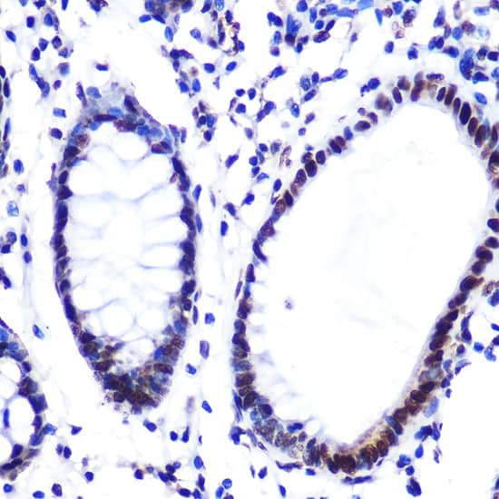 Immunohistochemistry: Histone H2AE [Hydroxy Tyr39] Antibody (2J2Q7) [NBP3-33534] - Immunohistochemistry analysis of paraffin-embedded Mouse colon tissue using Histone H2AE Rabbit mAb  at a dilution of 1:200 (40x lens). High pressure antigen retrieval was performed with 0.01 M citrate buffer (pH 6.0) prior to IHC staining.