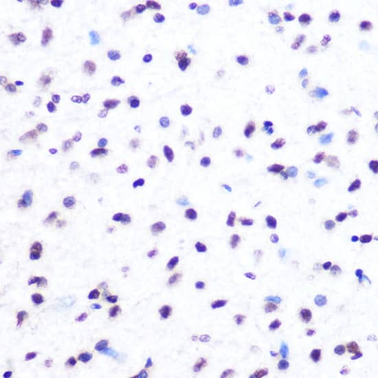 Immunohistochemistry: Histone H2AE [Hydroxy Tyr39] Antibody (2J2Q7) [NBP3-33534] - Immunohistochemistry analysis of paraffin-embedded Human small intestine tissue using Histone H2AE Rabbit mAb  at a dilution of 1:200 (40x lens). High pressure antigen retrieval was performed with 0.01 M citrate buffer (pH 6.0) prior to IHC staining.