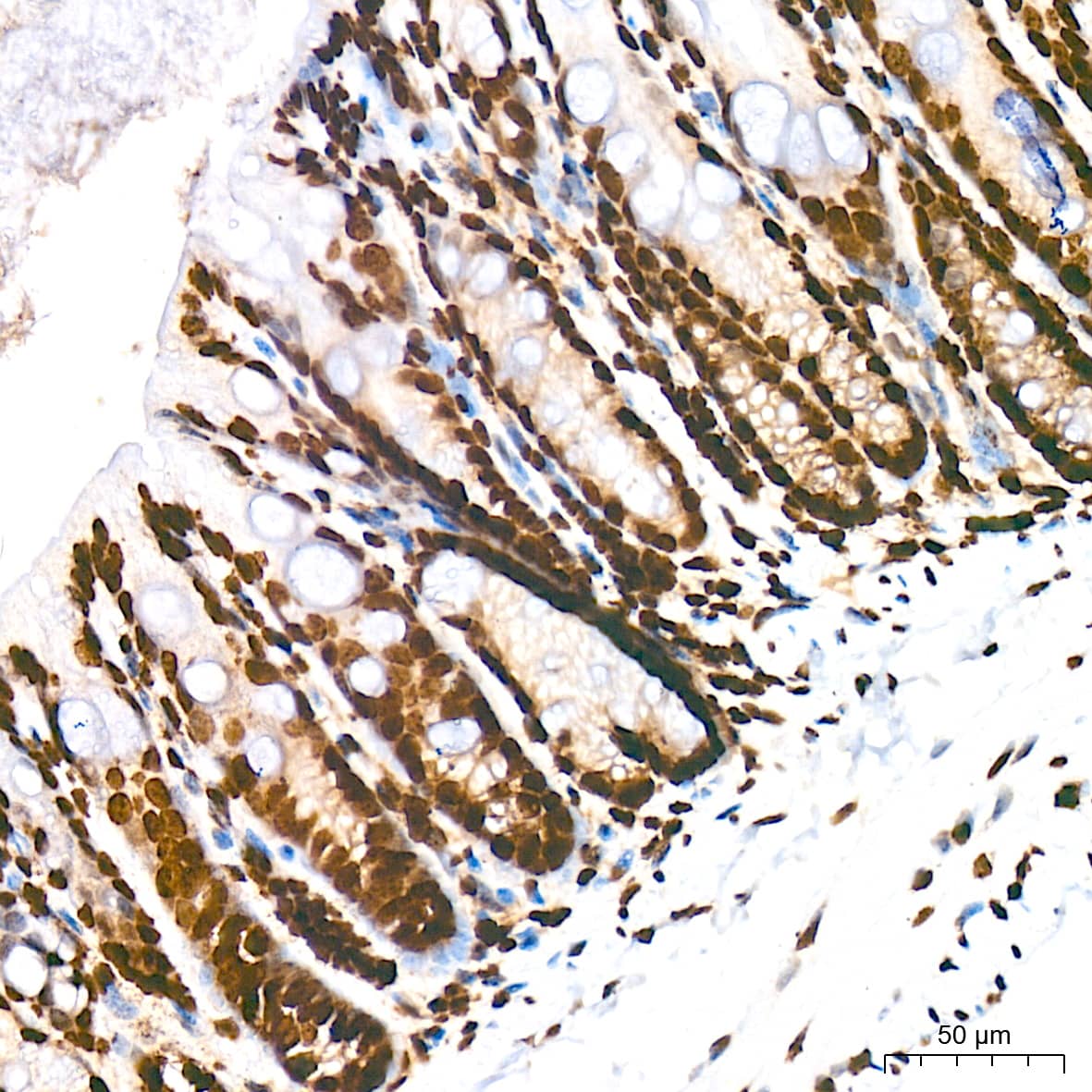 Immunohistochemistry: Histone H2AE [Hydroxy Tyr39] Antibody (2J2Q7) [NBP3-33534] - Immunohistochemistry analysis of Histone H2AE in paraffin-embedded mouse colon tissue using Histone H2AE Rabbit mAb at a dilution of 1:200 (40x lens). High pressure antigen retrieval was performed with 0.01 M citrate buffer (pH 6.0) prior to IHC staining.