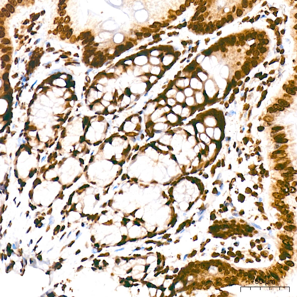 Immunohistochemistry: Histone H2AE [Hydroxy Tyr39] Antibody (2J2Q7) [NBP3-33534] - Immunohistochemistry analysis of Histone H2AE in paraffin-embedded rat colon tissue using Histone H2AE Rabbit mAb at a dilution of 1:200 (40x lens). High pressure antigen retrieval was performed with 0.01 M citrate buffer (pH 6.0) prior to IHC staining.