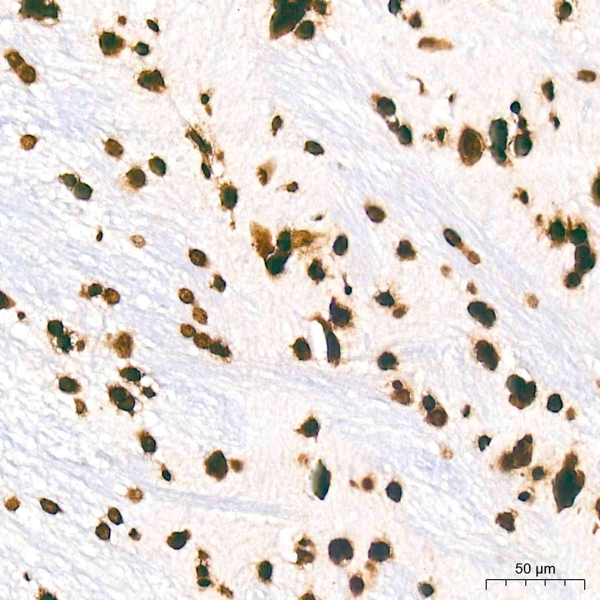 Immunohistochemistry: Histone H2AE [Hydroxy Tyr39] Antibody (2J2Q7) [NBP3-33534] - Immunohistochemistry analysis of Histone H2AE in paraffin-embedded rat brain tissue using Histone H2AE Rabbit mAb at a dilution of 1:200 (40x lens). High pressure antigen retrieval was performed with 0.01 M citrate buffer (pH 6.0) prior to IHC staining.