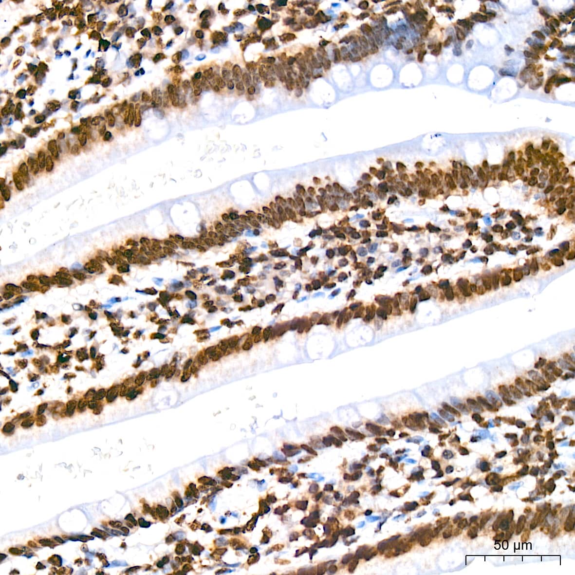 Immunohistochemistry: Histone H2AE [Hydroxy Tyr39] Antibody (2J2Q7) [NBP3-33534] - Immunohistochemistry analysis of Histone H2AE in paraffin-embedded human small intestine tissue using Histone H2AE Rabbit mAb at a dilution of 1:200 (40x lens). High pressure antigen retrieval was performed with 0.01 M citrate buffer (pH 6.0) prior to IHC staining.