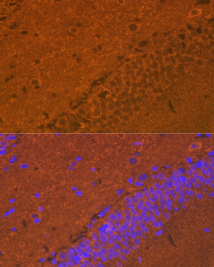 Immunocytochemistry/ Immunofluorescence: Synuclein alpha/beta Antibody (9E9X5) [NBP3-33536] - Immunofluorescence analysis of paraffin-embedded rat brain using Synuclein alpha/beta Rabbit mAb at dilution of 1:100 (40x lens). Secondary antibody: Cy3-conjugated Goat anti-Rabbit IgG (H+L) at 1:500 dilution. Blue: DAPI for nuclear staining.