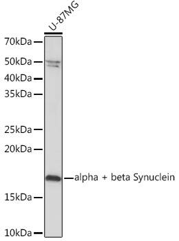 Western Blot Synuclein alpha/beta Antibody (9E9X5)