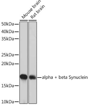 Western Blot: Synuclein alpha/beta Antibody (9E9X5) [NBP3-33536] - Western blot analysis of various lysates using Synuclein alpha/beta Rabbit mAb at 1:1000 dilution.Secondary antibody: HRP-conjugated Goat anti-Rabbit IgG (H+L) at 1:10000 dilution.Lysates/proteins: 25ug per lane.Blocking buffer: 3% nonfat dry milk in TBST.Detection: ECL Basic Kit.Exposure time: 1min.