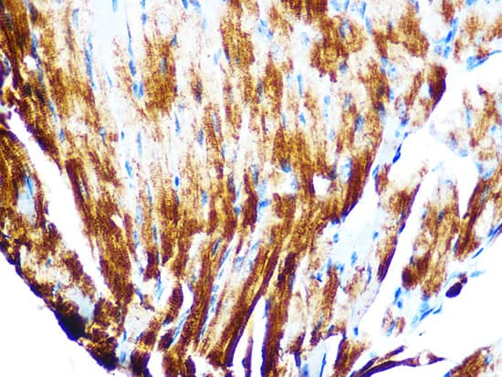 Immunocytochemistry/ Immunofluorescence: Cardiac Troponin T Antibody (10H9D8) [NBP3-33537] - Immunofluorescence analysis of paraffin-embedded mouse heart using Cardiac Troponin T(TNNT2) Rabbit mAb at dilution of 1:100 (40x lens). Secondary antibody: Cy3-conjugated Goat anti-Rabbit IgG (H+L) at 1:500 dilution. Blue: DAPI for nuclear staining.