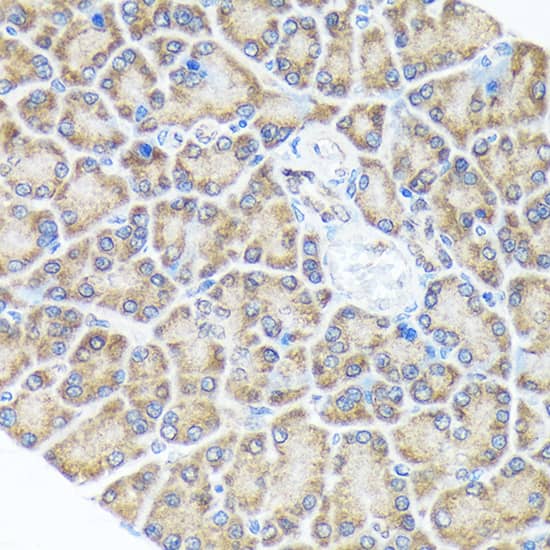 Immunohistochemistry: SPRY2 Antibody (10M8H1) [NBP3-33538] - Immunohistochemistry analysis of paraffin-embedded Rat pancreas using SPRY2 Rabbit mAb at dilution of 1:100 (40x lens). Microwave antigen retrieval performed with 0.01M Tris/EDTA Buffer (pH 9.0) prior to IHC staining.