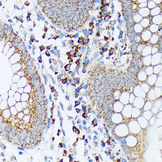 Immunohistochemistry: SPRY2 Antibody (10M8H1) [NBP3-33538] - Immunohistochemistry analysis of paraffin-embedded Human appendix using SPRY2 Rabbit mAb at dilution of 1:100 (40x lens). Microwave antigen retrieval performed with 0.01M Tris/EDTA Buffer (pH 9.0) prior to IHC staining.