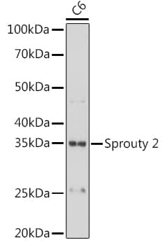 Western Blot: SPRY2 Antibody (10M8H1) [NBP3-33538] - Western blot analysis of lysates from C6 cells, using SPRY2 Rabbit mAb at 1:1000 dilution.Secondary antibody: HRP-conjugated Goat anti-Rabbit IgG (H+L) at 1:10000 dilution.Lysates/proteins: 25ug per lane.Blocking buffer: 3% nonfat dry milk in TBST.Detection: ECL Basic Kit.Exposure time: 10s.