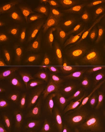 Immunohistochemistry: FUBP1 Antibody (1G6X5) [NBP3-33539] - Immunohistochemistry analysis of paraffin-embedded Mouse lung tissue using FUBP1 Rabbit mAb  at a dilution of 1:200 (40x lens). High pressure antigen retrieval was performed with 0.01 M citrate buffer (pH 6.0) prior to IHC staining.