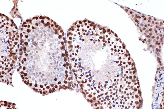 Immunohistochemistry: FUBP1 Antibody (1G6X5) [NBP3-33539] - Immunohistochemistry analysis of paraffin-embedded Rat liver tissue using FUBP1 Rabbit mAb  at a dilution of 1:200 (40x lens). High pressure antigen retrieval was performed with 0.01 M citrate buffer (pH 6.0) prior to IHC staining.