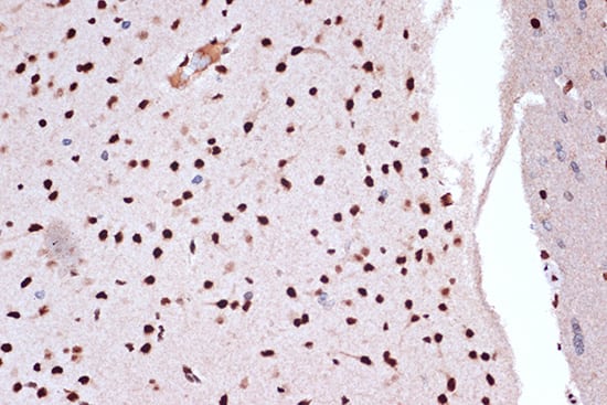 Immunohistochemistry: FUBP1 Antibody (1G6X5) [NBP3-33539] - Immunohistochemistry analysis of paraffin-embedded Human thyroid tissue using FUBP1 Rabbit mAb  at a dilution of 1:200 (40x lens). High pressure antigen retrieval was performed with 0.01 M citrate buffer (pH 6.0) prior to IHC staining.