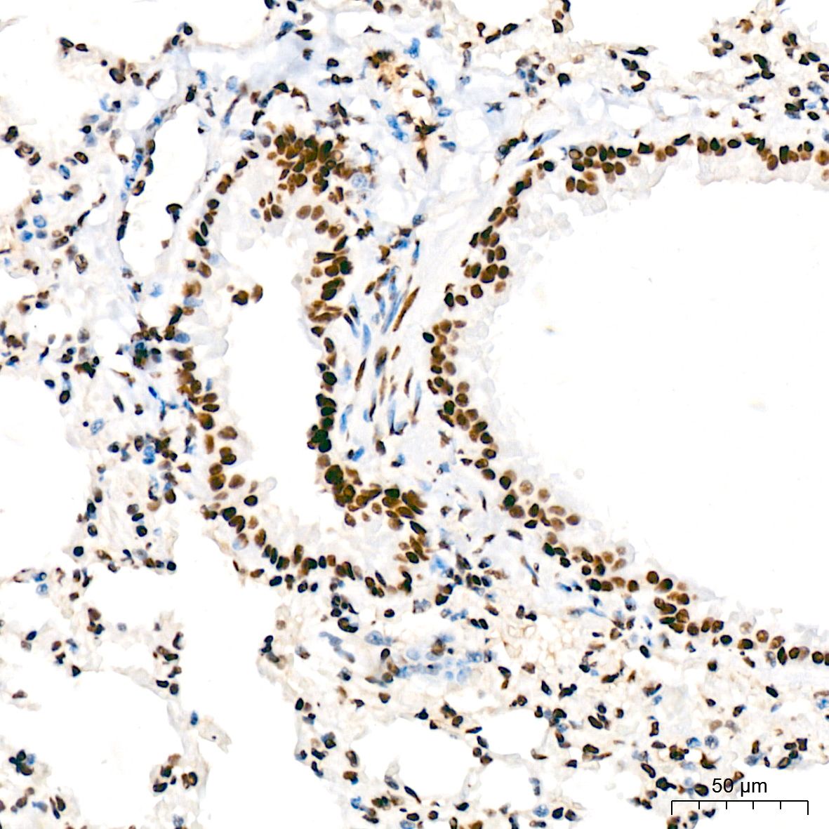 Immunohistochemistry: FUBP1 Antibody (1G6X5) [NBP3-33539] - Immunohistochemistry analysis of FUBP1 in paraffin-embedded mouse lung tissue using FUBP1 Rabbit mAb at a dilution of 1:200 (40x lens). High pressure antigen retrieval was performed with 0.01 M citrate buffer (pH 6.0) prior to IHC staining.