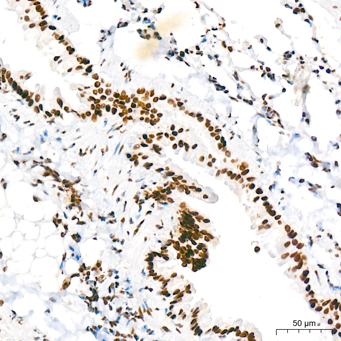 Immunohistochemistry: FUBP1 Antibody (1G6X5) [NBP3-33539] - Immunohistochemistry analysis of FUBP1 in paraffin-embedded rat lung tissue using FUBP1 Rabbit mAb at a dilution of 1:200 (40x lens). High pressure antigen retrieval was performed with 0.01 M citrate buffer (pH 6.0) prior to IHC staining.