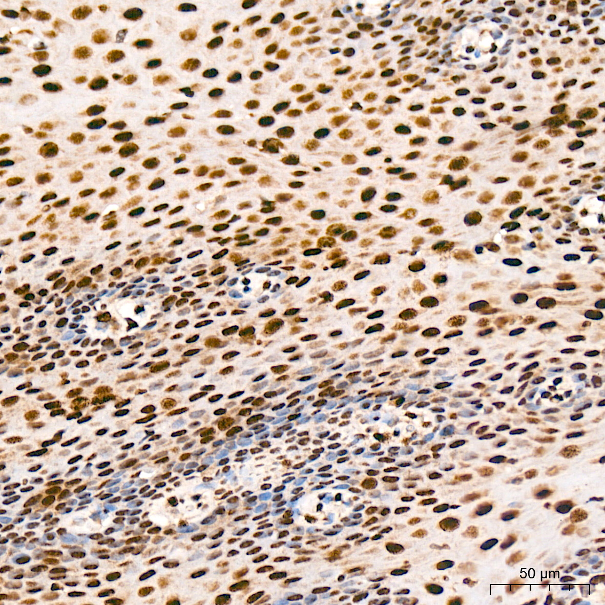 Immunohistochemistry: FUBP1 Antibody (1G6X5) [NBP3-33539] - Immunohistochemistry analysis of FUBP1 in paraffin-embedded human esophagus tissue using FUBP1 Rabbit mAb at a dilution of 1:200 (40x lens). High pressure antigen retrieval was performed with 0.01 M citrate buffer (pH 6.0) prior to IHC staining.