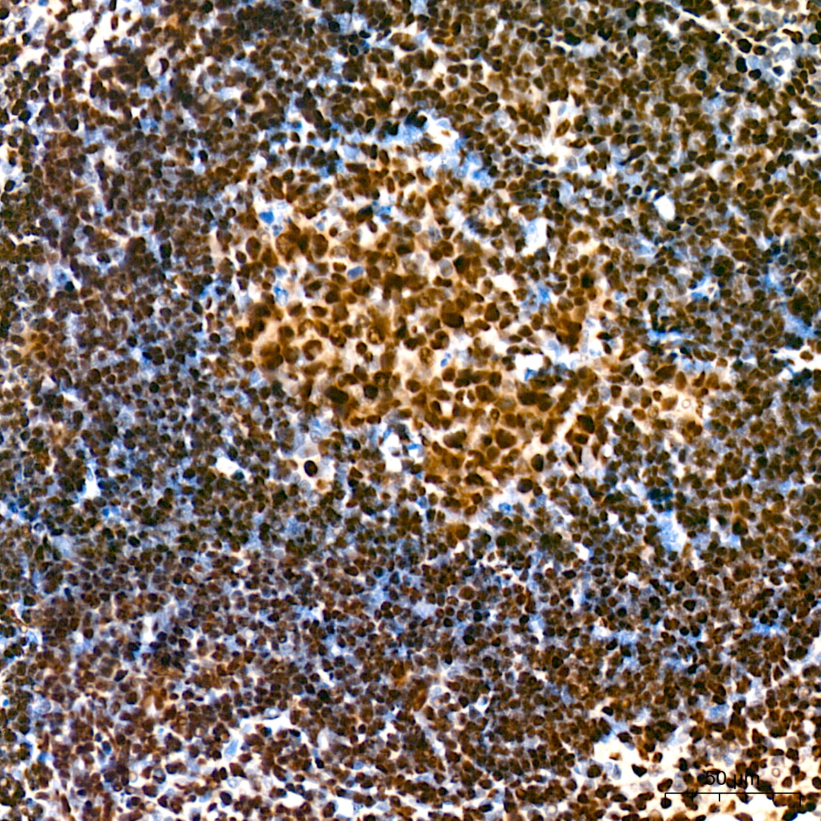 Immunohistochemistry: FUBP1 Antibody (1G6X5) [NBP3-33539] - Immunohistochemistry analysis of FUBP1 in paraffin-embedded mouse spleen tissue using FUBP1 Rabbit mAb at a dilution of 1:200 (40x lens). High pressure antigen retrieval was performed with 0.01 M citrate buffer (pH 6.0) prior to IHC staining.