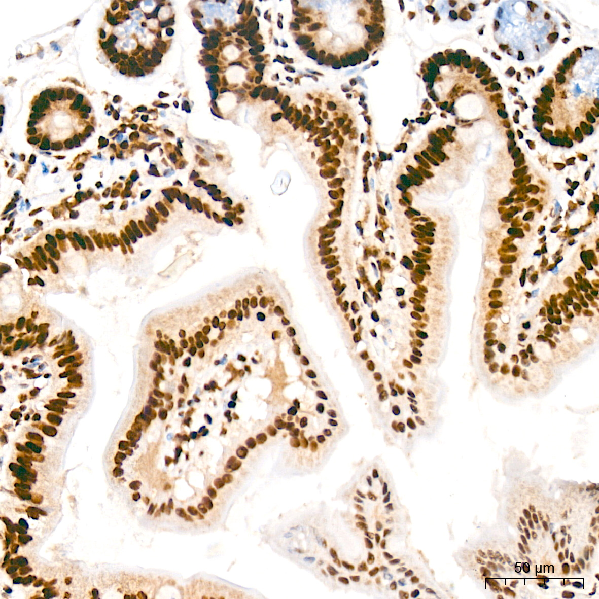 Immunohistochemistry: FUBP1 Antibody (1G6X5) [NBP3-33539] - Immunohistochemistry analysis of FUBP1 in paraffin-embedded mouse intestin tissue using FUBP1 Rabbit mAb at a dilution of 1:200 (40x lens). High pressure antigen retrieval was performed with 0.01 M citrate buffer (pH 6.0) prior to IHC staining.