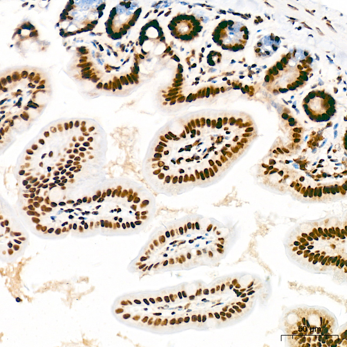 Immunohistochemistry: FUBP1 Antibody (1G6X5) [NBP3-33539] - Immunohistochemistry analysis of FUBP1 in paraffin-embedded rat intestine tissue using FUBP1 Rabbit mAb at a dilution of 1:200 (40x lens). High pressure antigen retrieval was performed with 0.01 M citrate buffer (pH 6.0) prior to IHC staining.