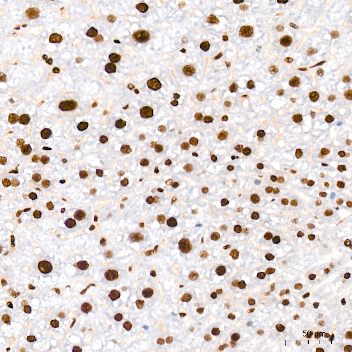 Immunohistochemistry: FUBP1 Antibody (1G6X5) [NBP3-33539] - Immunohistochemistry analysis of FUBP1 in paraffin-embedded rat liver tissue using FUBP1 Rabbit mAb at a dilution of 1:200 (40x lens). High pressure antigen retrieval was performed with 0.01 M citrate buffer (pH 6.0) prior to IHC staining.