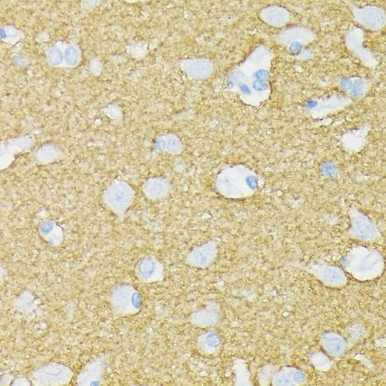 Immunohistochemistry: Syntaxin-BP1 Antibody (1N7U1) [NBP3-33541] - Immunohistochemistry analysis of paraffin-embedded Human brain tissue using Syntaxin-BP1 Rabbit mAb at a dilution of 1:200 (40x lens). High pressure antigen retrieval performed with 0.01M Citrate Bufferr (pH 6.0) prior to IHC staining.