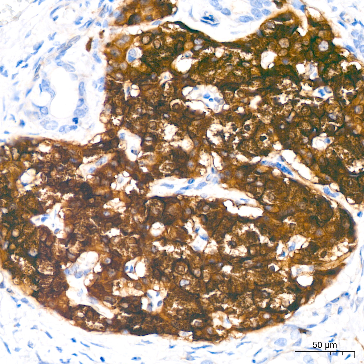 Immunohistochemistry: Syntaxin-BP1 Antibody (1N7U1) [NBP3-33541] - Immunohistochemistry analysis of Syntaxin-BP1 in paraffin-embedded human pancreas tissue using Syntaxin-BP1 Rabbit mAb at a dilution of 1:200 (40x lens).High pressure antigen retrieval was performed with 0.01 M citrate buffer (pH 6.0) prior to IHC staining.