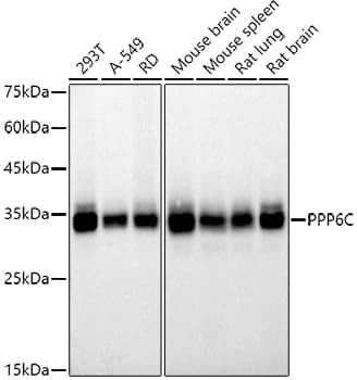 Western Blot: PPP6C Antibody (6O2N8) [NBP3-33542] - Western blot analysis of various lysates using  at 1:500 dilution.Secondary antibody: HRP-conjugated Goat anti-Rabbit IgG (H+L) at 1:10000 dilution.Lysates/proteins: 25μg per lane.Blocking buffer: 3% nonfat dry milk in TBST.Detection: ECL Basic Kit.Exposure time: 10s.