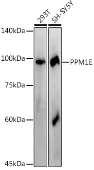 Western Blot PPM1E Antibody (2L7W0)