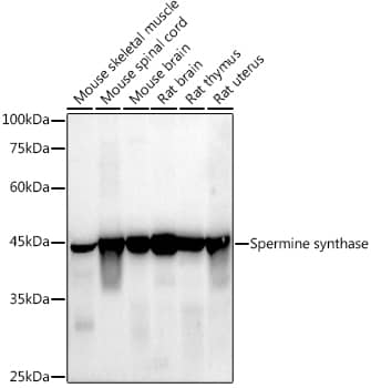 Western Blot: Spermine synthase Antibody (1U7C7) [NBP3-33548] - Western blot analysis of various lysates using  at 1:1000 dilution.Secondary antibody: HRP-conjugated Goat anti-Rabbit IgG (H+L) at 1:10000 dilution.Lysates/proteins: 25μg per lane.Blocking buffer: 3% nonfat dry milk in TBST.Detection: ECL Enhanced Kit.Exposure time: 30s.