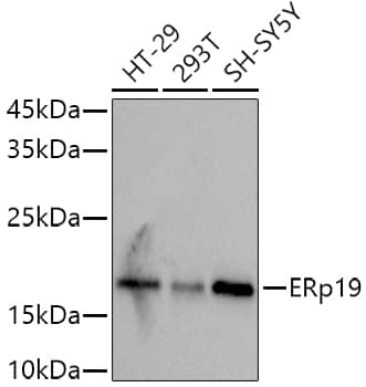 Western Blot: TXNDC12 Antibody (9J6L2) [NBP3-33549] - Western blot analysis of various lysates using  at 1:1000 dilution.Secondary antibody: HRP-conjugated Goat anti-Rabbit IgG (H+L) at 1:10000 dilution.Lysates/proteins: 25μg per lane.Blocking buffer: 3% nonfat dry milk in TBST.Detection: ECL Basic Kit.Exposure time: 3s.