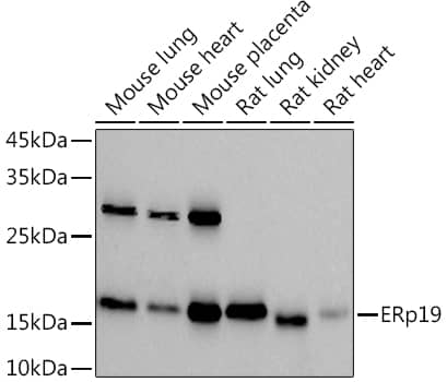 Western Blot: TXNDC12 Antibody (9J6L2) [NBP3-33549] - Western blot analysis of various lysates using  at 1:1000 dilution.Secondary antibody: HRP-conjugated Goat anti-Rabbit IgG (H+L) at 1:10000 dilution.Lysates/proteins: 25μg per lane.Blocking buffer: 3% nonfat dry milk in TBST.Detection: ECL Basic Kit.Exposure time: 90s.