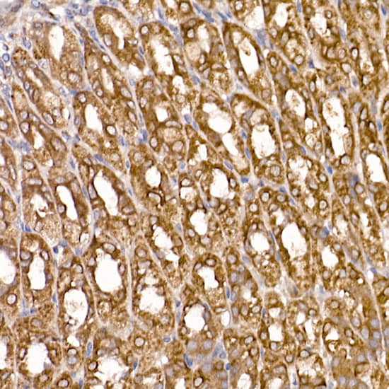 Immunohistochemistry TXNDC12 Antibody (9J6L2)