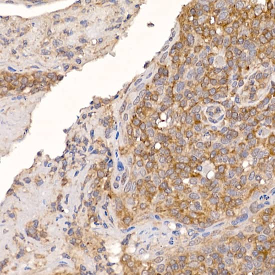 Immunohistochemistry: TXNDC12 Antibody (9J6L2) [NBP3-33549] - Immunohistochemistry analysis of paraffin-embedded Human tonsil using TXNDC12 Rabbit mAb at dilution of 1:200 (40x lens). High pressure antigen retrieval performed with 0.01M Citrate Bufferr (pH 6.0) prior to IHC staining.