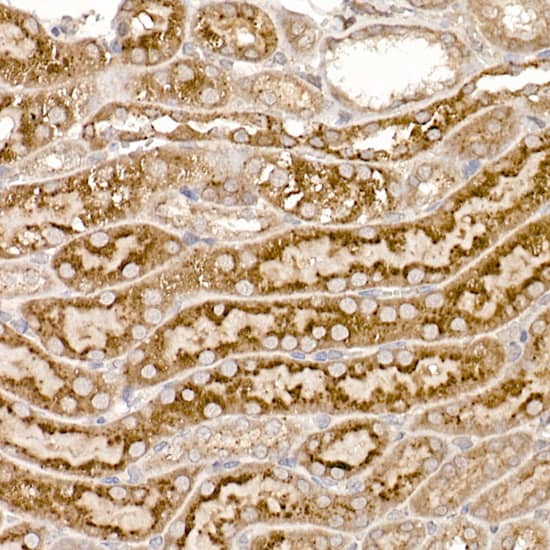 Immunohistochemistry: TXNDC12 Antibody (9J6L2) [NBP3-33549] - Immunohistochemistry analysis of paraffin-embedded Mouse kidney using TXNDC12 Rabbit mAb at dilution of 1:200 (40x lens). High pressure antigen retrieval performed with 0.01M Citrate Bufferr (pH 6.0) prior to IHC staining.