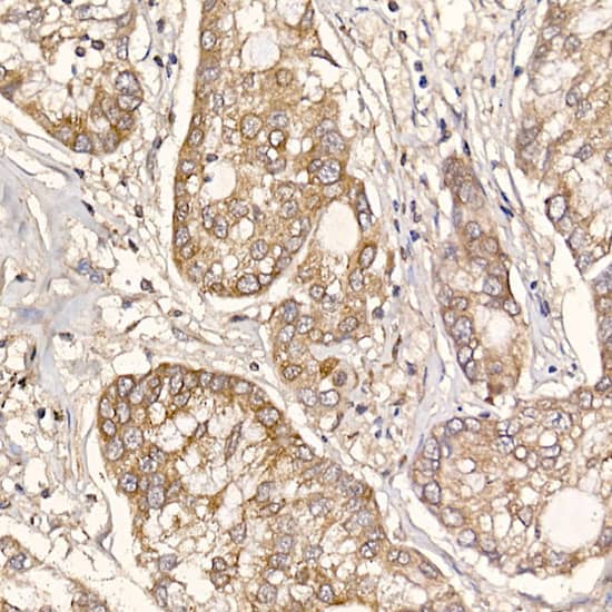 Immunohistochemistry TXNDC12 Antibody (9J6L2)