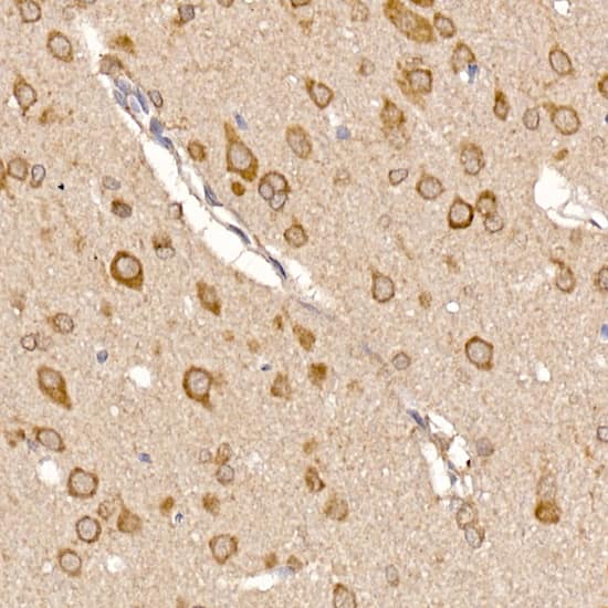 Immunohistochemistry TXNDC12 Antibody (9J6L2)