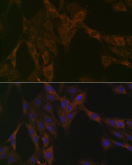 Immunocytochemistry/ Immunofluorescence: DDX6 Antibody (6F9I6) [NBP3-33553] - Immunofluorescence analysis of C6 cells using DDX6 Rabbit mAb at dilution of 1:100 (40x lens). Blue: DAPI for nuclear staining.