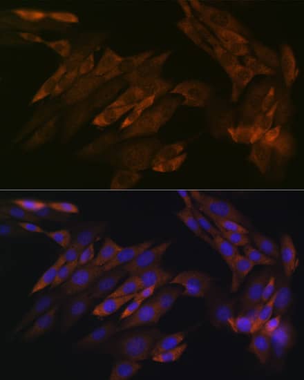 Immunocytochemistry/ Immunofluorescence: DDX6 Antibody (6F9I6) [NBP3-33553] - Immunofluorescence analysis of NIH-3T3 cells using DDX6 Rabbit mAb at dilution of 1:100 (40x lens). Secondary antibody: Cy3-conjugated Goat anti-Rabbit IgG (H+L) at 1:500 dilution. Blue: DAPI for nuclear staining.