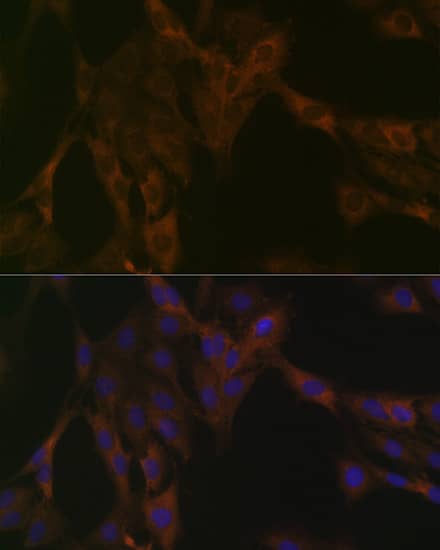 Immunocytochemistry/ Immunofluorescence: DDX6 Antibody (6F9I6) [NBP3-33553] - Immunofluorescence analysis of C6 cells using DDX6 Rabbit mAb at dilution of 1:100 (40x lens). Secondary antibody: Cy3-conjugated Goat anti-Rabbit IgG (H+L) at 1:500 dilution. Blue: DAPI for nuclear staining.