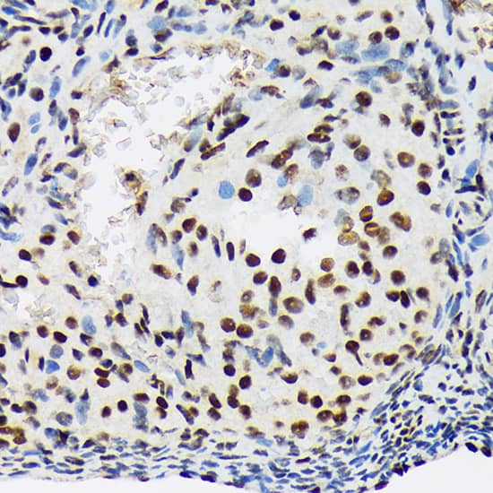 Immunohistochemistry SAP155 Antibody (4A3G9)