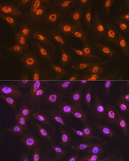 Immunohistochemistry SAP155 Antibody (4A3G9)