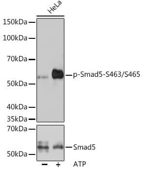 Western Blot: Smad5 [p Ser465, p Ser463] Antibody (8F4B10) [NBP3-33557] - Western blot analysis of lysates from HeLa cells, using Smad5 Rabbit mAb at 1:1000 dilution or Smad5 antibody. Hela cells were treated by ATP(5 mM) at 30C for 1 hour.Secondary antibody: HRP-conjugated Goat anti-Rabbit IgG (H+L) at 1:10000 dilution.Lysates/proteins: 25ug per lane.Blocking buffer: 3% BSA.Detection: ECL Basic Kit.Exposure time: 3min.
