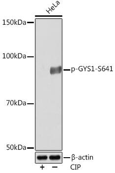 Western Blot: Glycogen Synthase [p Ser641] Antibody (6T9W4) [NBP3-33559] - Western blot analysis of various lysates using Glycogen Synthase Rabbit mAb at 1:1000 dilution. Hela cells were treated by CIP(20uL/400ul) at 37C for 1 hour.Secondary antibody: HRP-conjugated Goat anti-Rabbit IgG (H+L) at 1:10000 dilution.Lysates/proteins: 25ug per lane.Blocking buffer: 3% BSA.Detection: ECL Basic Kit.Exposure time: 10s.