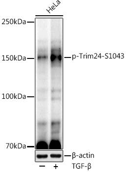 Western Blot: TIF1 alpha [p Ser1043] Antibody (7N5L6) [NBP3-33568] - Western blot analysis of lysates from HeLa cells, using TIF1 alpha Rabbit mAb at1:1000 dilution. Hela cells were treated by TGF-beta (10 ng/ml) at 37C for 30 minutes.Secondary antibody: HRP-conjugated Goat anti-Rabbit IgG (H+L) at1:10000 dilution.Lysates/proteins: 25ug per lane.Blocking buffer: 3% nonfat dry milk in TBST.Detection: ECL Enhanced Kit.Exposure time: 180s.