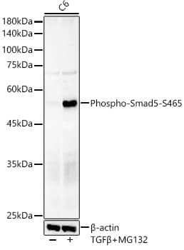 Western Blot: Smad5 [p Ser465] Antibody (2Q7T2) [NBP3-33574] - Western blot analysis of lysates from C6 cells, using Smad5 Rabbit mAb at 1:2000 dilution. C6 cells were treated by MG132(50 uM) and TGFbeta at 37C for 90 minutes.Secondary antibody: HRP-conjugated Goat anti-Rabbit IgG (H+L) at 1:10000 dilution.Lysates/proteins: 25ug per lane.Blocking buffer: 3% nonfat dry milk in TBST.Detection: ECL Basic Kit.Exposure time: 180s.