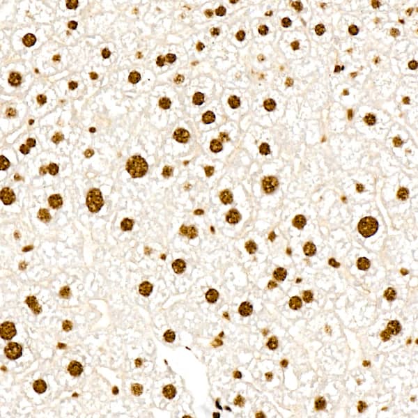 Immunohistochemistry: PERK [p Thr982] Antibody (0A1E6) [NBP3-33575] - Immunohistochemistry analysis of paraffin-embedded Mouse liver using PERK Rabbit mAb at dilution of 1:200 (40x lens). High pressure antigen retrieval performed with 0.01M Citrate Bufferr (pH 6.0) prior to IHC staining.