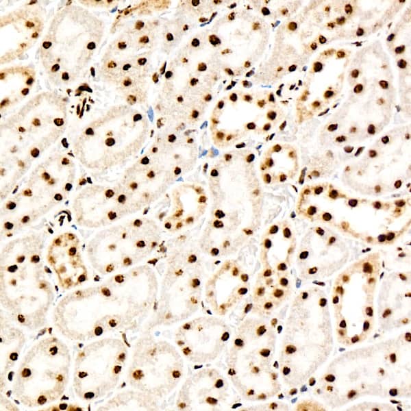 Immunohistochemistry: PERK [p Thr982] Antibody (0A1E6) [NBP3-33575] - Immunohistochemistry analysis of paraffin-embedded Mouse kidney using PERK Rabbit mAb at dilution of 1:200 (40x lens). High pressure antigen retrieval performed with 0.01M Citrate Bufferr (pH 6.0) prior to IHC staining.