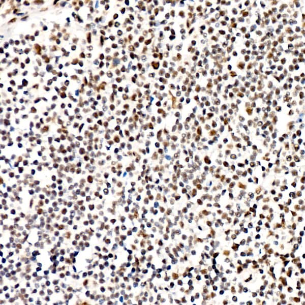 Immunohistochemistry: PERK [p Thr982] Antibody (0A1E6) [NBP3-33575] - Immunohistochemistry analysis of paraffin-embedded Human tonsil using PERK Rabbit mAb at dilution of 1:200 (40x lens). High pressure antigen retrieval performed with 0.01M Citrate Bufferr (pH 6.0) prior to IHC staining.