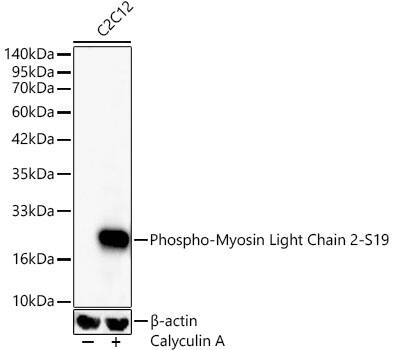 Western Blot: MYL9 [p Ser19] Antibody (6D8B7) [NBP3-33577] - Western blot analysis of lysates from C2C12 cells, using MYL9 Rabbit mAb at 1:1000 dilution. C2C12 cells were treated by Calyculin A (100 nM) at 37C for 30 minutes after serum-starvation overnight.Secondary antibody: HRP-conjugated Goat anti-Rabbit IgG (H+L) at 1:10000 dilution.Lysates/proteins: 25ug per lane.Blocking buffer: 3% nonfat dry milk in TBST.Detection: ECL Basic Kit.Exposure time: 15s.